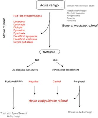 Hyperacute assessment of vertigo in suspected stroke